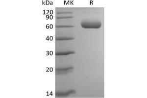 Western Blotting (WB) image for Sialic Acid Binding Ig-Like Lectin 5 (SIGLEC5) protein (His tag) (ABIN7320919)