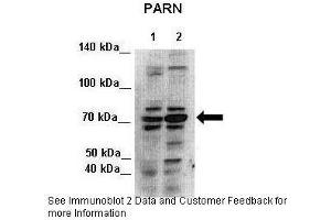 Lanes:   Lane 1: 7ug HEK293 cytoplasmic lysate  2: 7ug HEK293 nuclei lysate  Primary Antibody Dilution:   1:500  Secondary Antibody:   Anti-rabbit-HRP  Secondary Antibody Dilution:   1:500  Gene Name:   PARN  Submitted by:   Seiji Masuda, Kitashirakawa Oiwakecho, Kyoto University (PARN Antikörper  (N-Term))