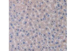 IHC-P analysis of Mouse Tissue, with DAB staining. (IRS1 Antikörper  (AA 837-1089))