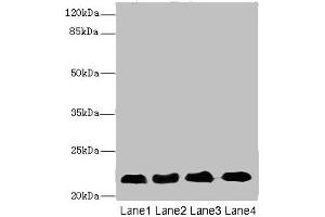Western blot All lanes: CRIP2 antibody at 5. (CRIP2 Antikörper  (AA 1-208))