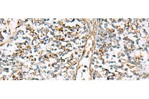 Immunohistochemistry of paraffin-embedded Human tonsil tissue using NPC2 Polyclonal Antibody at dilution of 1:80(x200)