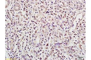 Immunohistochemistry (IHC) image for anti-Recombination Signal Binding Protein For Immunoglobulin kappa J Region (RBPJ) (AA 101-200) antibody (ABIN872972)