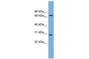 Western Blot showing SEMG2 antibody used at a concentration of 1-2 ug/ml to detect its target protein. (SEMG2 Antikörper  (N-Term))