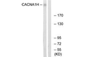 Western blot analysis of extracts from A549 cells, using CACNA1H Antibody. (CACNA1H Antikörper  (AA 462-511))