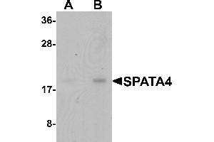 Western Blotting (WB) image for anti-Spermatogenesis Associated Protein 4 (SPATA4) (C-Term) antibody (ABIN1077367) (SPATA4 Antikörper  (C-Term))