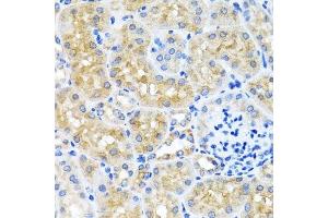 Immunohistochemistry of paraffin-embedded mouse kidney using SCO1 antibody. (SCO1 Antikörper  (AA 1-160))