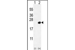 Western blot analysis of DOK5 (arrow) using rabbit polyclonal DOK5 Antibody  (ABIN392075 and ABIN2841837).