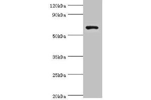 Western blot All lanes: Glutamate decarboxylase 1 antibody at 8 μg/mL + HepG2 whole cell lysate Secondary Goat polyclonal to rabbit IgG at 1/10000 dilution Predicted band size: 67, 26, 48 kDa Observed band size: 67 kDa (GAD Antikörper  (AA 1-200))