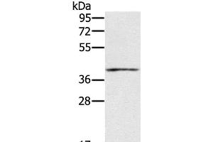 Western Blot analysis of Mouse muscle tissue using IFNGR2 Polyclonal Antibody at dilution of 1:200 (IFNGR2 Antikörper)
