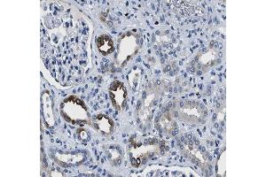 ABIN6266549 at 1/100 staining human kidney tissue sections by IHC-P. (GRIK1 Antikörper  (Internal Region))