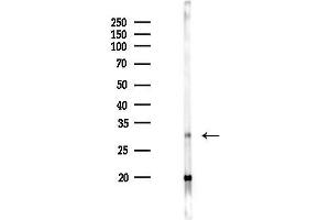 anti-Alkaline Ceramidase 3 (ACER3) (Internal Region) antibody