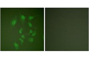 Immunofluorescence analysis of HepG2 cells, using Smad2 (Ab-467) Antibody. (SMAD2 Antikörper  (AA 418-467))