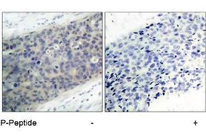 Image no. 3 for anti-LIM Domain Kinase 2 (LIMK2) (pThr505) antibody (ABIN196832) (LIMK2 Antikörper  (pThr505))