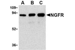 Image no. 1 for anti-Nerve Growth Factor Receptor (NGFR) antibody (ABIN318704) (NGFR Antikörper)