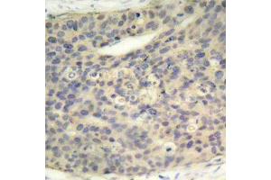 Immunohistochemistry (IHC) image for anti-LIM Domain Kinase 1 (LIMK1) (pThr508) antibody (ABIN1681739) (LIM Domain Kinase 1 Antikörper  (pThr508))