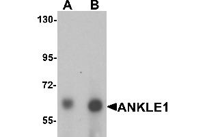 Western blot analysis of ANKLE1 in 293 cell lysate with ANKLE1 antibody at (A) 1 and (B) 2 µg/mL. (ANKLE1 Antikörper  (C-Term))