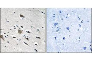 Immunohistochemistry analysis of paraffin-embedded human brain tissue, using MRPL52 Antibody. (MRPL52 Antikörper  (AA 71-120))