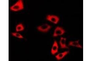 Immunofluorescent analysis of Calsarcin 1 staining in U2OS cells. (MYOZ2 Antikörper)