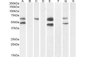 (ABIN570984) (1 μg/mL) staining of Human Cerebral Cortex (A) + peptide (B), (0. (CaMKII alpha/beta (Internal Region) Antikörper)