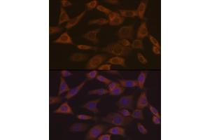 Immunofluorescence analysis of NIH-3T3 cells using Ephrin  Rabbit mAb (ABIN7266976) at dilution of 1:100 (40x lens). (Ephrin A1 Antikörper)