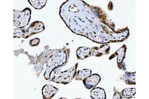 IHC analysis of CSNK2K2 using anti-CSNK2K2 antibody (ABIN7602871). (CSNK2A2 Antikörper  (C-Term))