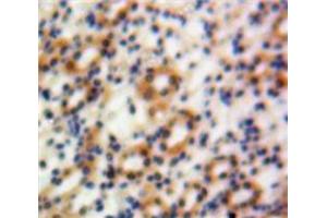 Used in DAB staining on fromalin fixed paraffin-embedded Kidney tissue (Granulin Antikörper  (AA 361-585))