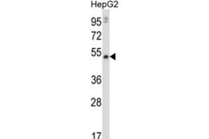Western Blotting (WB) image for anti-Matrix Metalloproteinase 20 (MMP20) antibody (ABIN2997607) (MMP20 Antikörper)