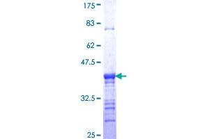 Image no. 1 for Casein beta (CSN2) (AA 127-226) protein (GST tag) (ABIN1350525)