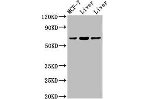 Western Blot Positive WB detected in: Rat liver tissue, Mouse liver issue All lanes: PTH1R antibody at 2 μg/mL Secondary Goat polyclonal to rabbit IgG at 1/50000 dilution Predicted band size: 67 kDa Observed band size: 67 kDa (PTH1R Antikörper  (AA 485-593))