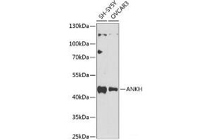 Western blot analysis of extracts of various cell lines using ANKH Polyclonal Antibody at dilution of 1:1000. (ANKH Antikörper)