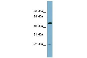 WB Suggested Anti-UCHL5IP Antibody Titration: 0. (HAUS7 Antikörper  (Middle Region))