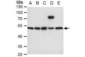 Western Blotting (WB) image for anti-Integrin-Linked Kinase (ILK) antibody (ABIN2854345)
