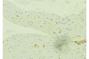 ABIN6276491 at 1/100 staining Mouse liver tissue by IHC-P. (SLC27A2 Antikörper  (N-Term))