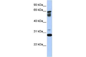 WB Suggested Anti-TMEM187  Antibody Titration: 0.