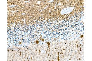 Immunohistochemistry (IHC) image for anti-Tubulin, beta 3 (TUBB3) (AA 400-450) antibody (ABIN7453957)