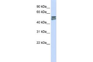 WB Suggested Anti-G6PD Antibody Titration: 0. (Glucose-6-Phosphate Dehydrogenase Antikörper  (Middle Region))