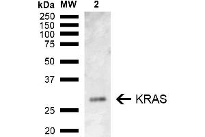 Western blot analysis of Rat Kidney showing detection of ~21. (K-RAS Antikörper  (AA 100-189) (PE))