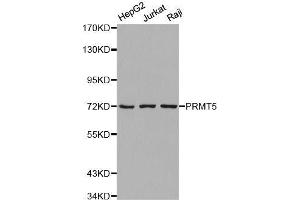 Western blot analysis of extracts of various cell lines, using PRMT5 antibody. (PRMT5 Antikörper  (C-Term))