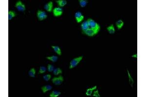 Immunofluorescence staining of Hela cells with ABIN7146593 at 1:50, counter-stained with DAPI. (Calsyntenin 3 Antikörper  (AA 197-408))