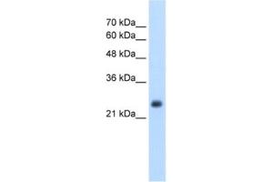 Western Blotting (WB) image for anti-Nicotinamide N-Methyltransferase (NNMT) antibody (ABIN2462559) (NNMT Antikörper)