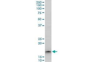TOMM22 polyclonal antibody (A01), Lot # 051206JC01. (TOMM22 Antikörper  (AA 1-142))
