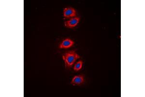 Immunofluorescent analysis of RPS6 (pS240) staining in HeLa cells. (RPS6 Antikörper  (C-Term, pSer240))