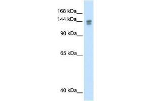 TP53BP2 antibody used at 1. (TP53BP2 Antikörper  (N-Term))