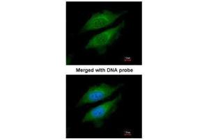 ICC/IF Image Immunofluorescence analysis of paraformaldehyde-fixed HeLa, using DPRP1 , antibody at 1:200 dilution. (DPP8 Antikörper  (N-Term))