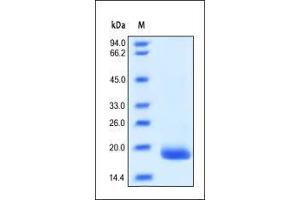 SDS-PAGE (SDS) image for Colony Stimulating Factor 3 (Granulocyte) (CSF3) (AA 31-204) (Active) protein (ABIN2181135) (G-CSF Protein (AA 31-204))