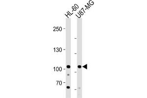 Western Blotting (WB) image for anti-MORC Family CW-Type Zinc Finger 3 (MORC3) antibody (ABIN3004591) (MORC3 Antikörper)