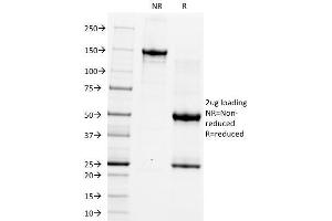 SDS-PAGE Analysis Purified CD5 Monoclonal Antibody (CRIS-1). (CD5 Antikörper)