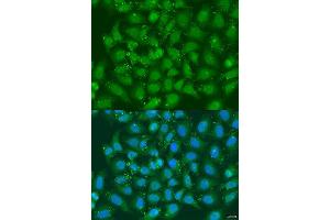 Immunofluorescence analysis of U2OS cells using XBP1 antibody.