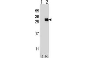 Western blot analysis of UBTD1 (arrow) using rabbit polyclonal UBTD1 Antibody . (UBTD1 Antikörper)