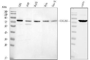Western blot analysis of Caldesmon using anti-Caldesmon antibody (ABIN4886498). (Caldesmon Antikörper  (AA 1-120))